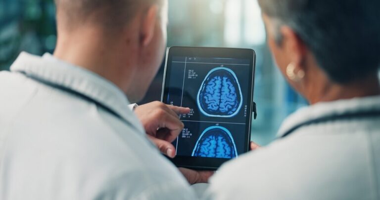 Grafico sull'incidenza del declino cognitivo nei pazienti con fibrillazione atriale